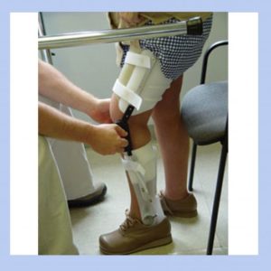 圖中顯示足科矯形師為顧客度身訂造腳托afo