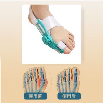 香港足脊檢查中心有售拇趾外翻可調較矯正器
