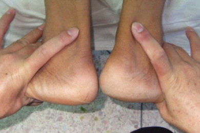 長短腳 高低腳 可致膝痛 腳痛 盆骨傾斜