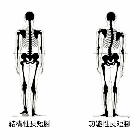 香港足脊檢查中心為長短腳患者提供訂造鞋墊及加高鞋服務