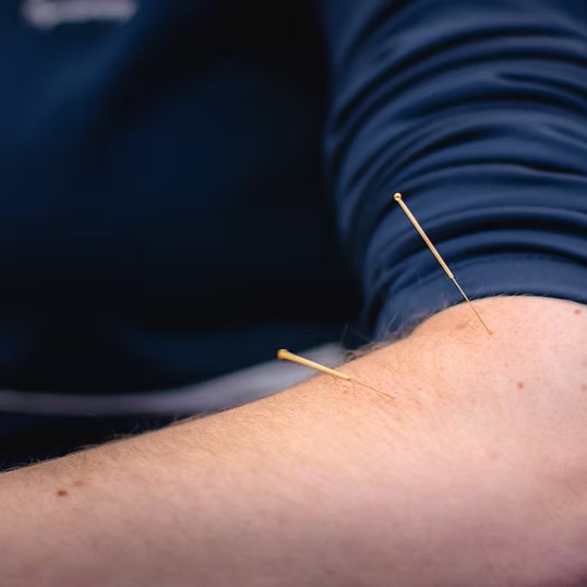 香港足脊檢查中心提供物理治療服務，其中一項為針灸
